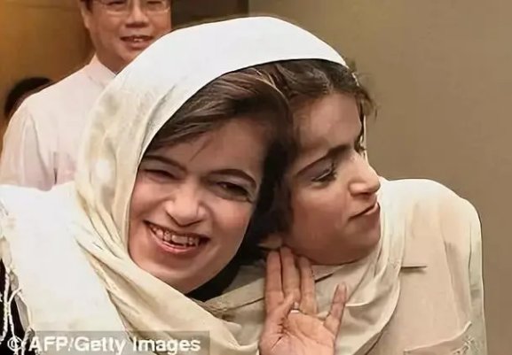 最诡异的双头连体人，两个大脑如何控制同一个身躯？