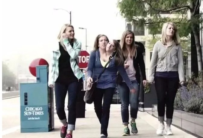 最诡异的双头连体人，两个大脑如何控制同一个身躯？