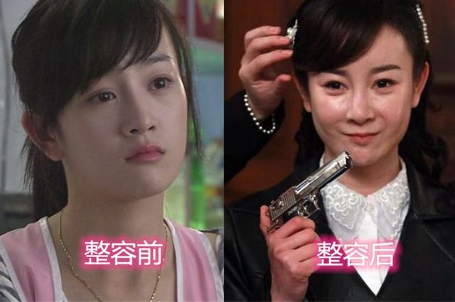 回顾33岁张檬情史，因恋爱脑整容自毁前程，与小五相恋三年后领证？