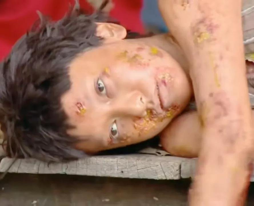 《赤金》泰剧女主得了什么病?