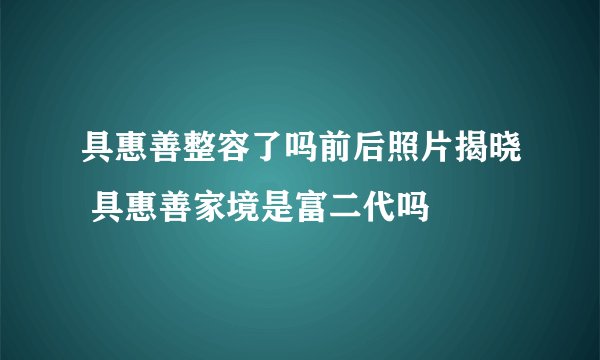 具惠善整容了吗前后照片揭晓 具惠善家境是富二代吗