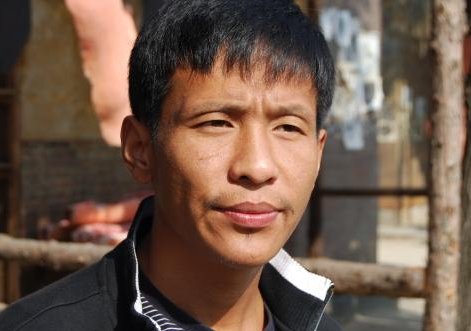 宋小宝为什么会得肝硬化？