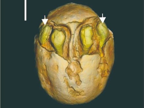 古生物学者发现1500万年前的枣化石,这化石长啥样?