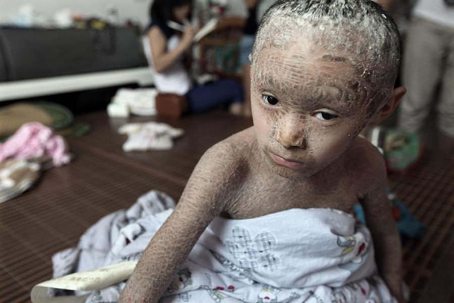 树皮娃娃的介绍