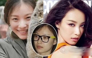 南京一医院开黑眼圈门诊，这个门诊的病人多吗？