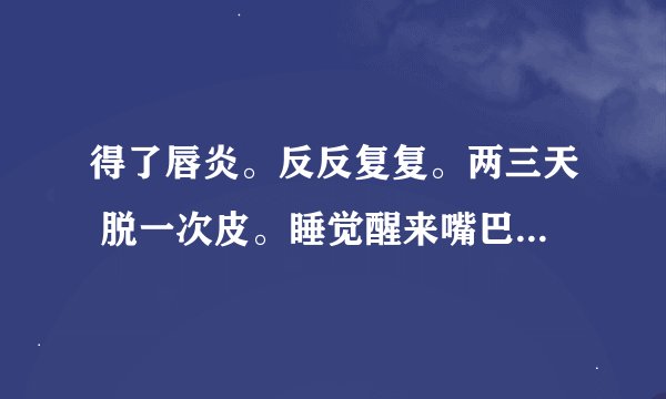 得了唇炎。反反复复。两三天 脱一次皮。睡觉醒来嘴巴张不开，吃了很多药，就是不好。谁来帮我