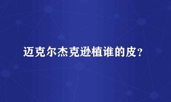 迈克尔杰克逊植谁的皮？