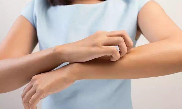 蚂蚁庄园为什么皮肤越抓越痒