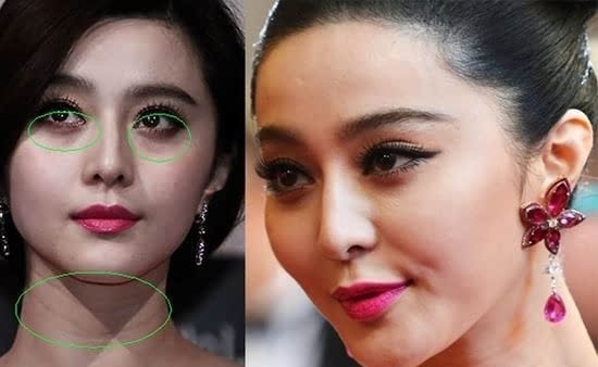 南京一医院开黑眼圈门诊，这个门诊的病人多吗？