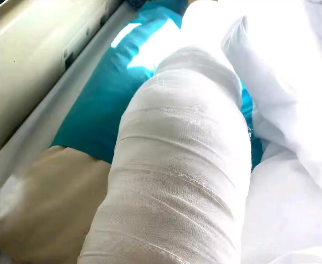 severed是什么意思