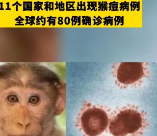 成都出现猴痘病例系不实信息！现在国内有几例猴痘病例？