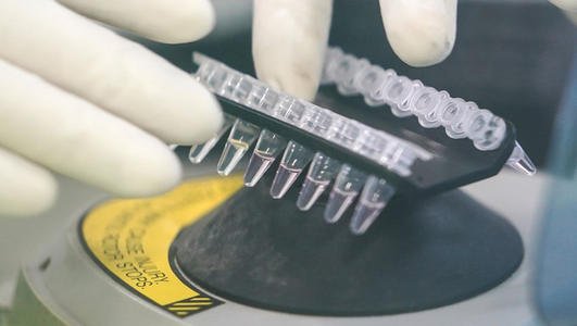 官方通报，河南发现一例新冠复阳无症状感染者，当地采取了什么举措？