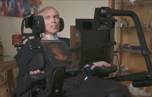 赛博格是一种什么东西？世界上第一个真正的赛博格是谁？