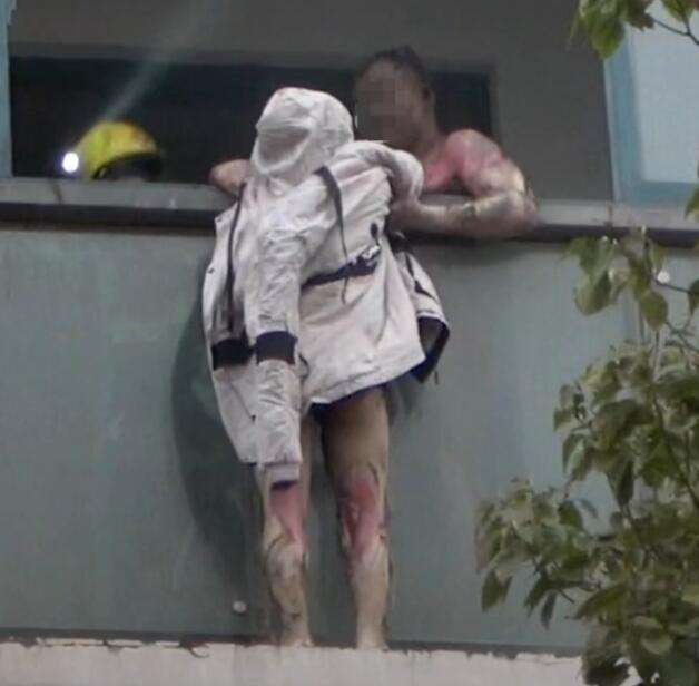 火灾中舍身救妻的丈夫凌晨去世，此事背后有着怎样令人感动的故事？