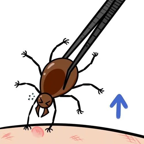 杭州阿姨臀部冒出一颗“黑痣”，仔细一看还在慢慢变大，这到底是什么？