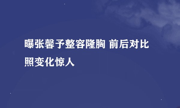 曝张馨予整容隆胸 前后对比照变化惊人