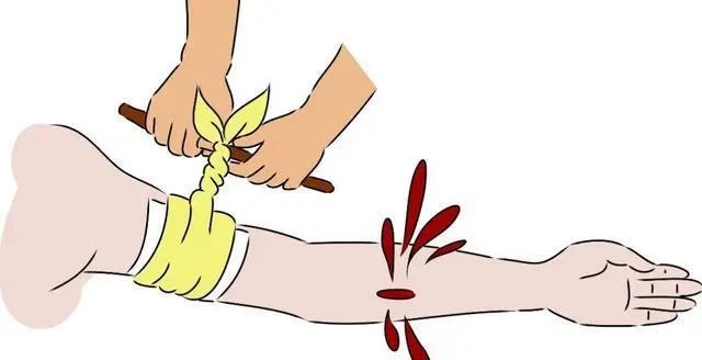 重庆女子江边散步被蛇咬伤肿胀如馒头，在江边散步需要注意什么？