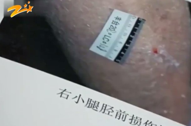 保姆虐打85岁老人辩称是闹着玩，法庭上痛哭，是作秀还是真后悔了？