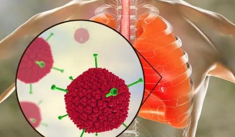 乐山2名儿童检出腺病毒，腺病毒是什么？夏季游泳如何避免腺病毒感染？