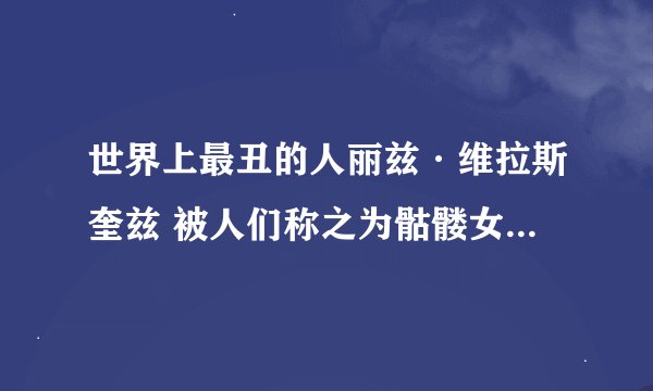 世界上最丑的人丽兹·维拉斯奎兹 被人们称之为骷髅女孩(2)