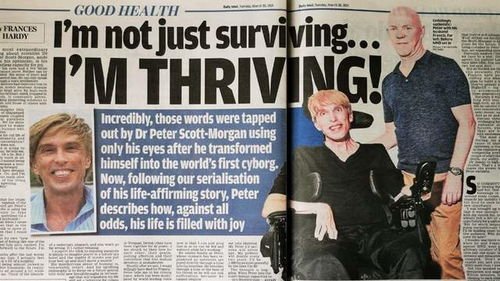 赛博格是一种什么东西？世界上第一个真正的赛博格是谁？