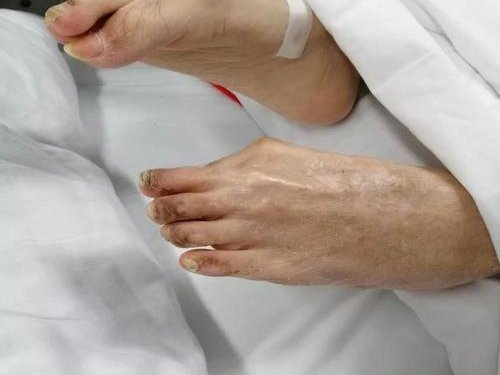 MD是什么意思？